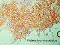 Pluteus brunneoradiatus-micro-amf1482